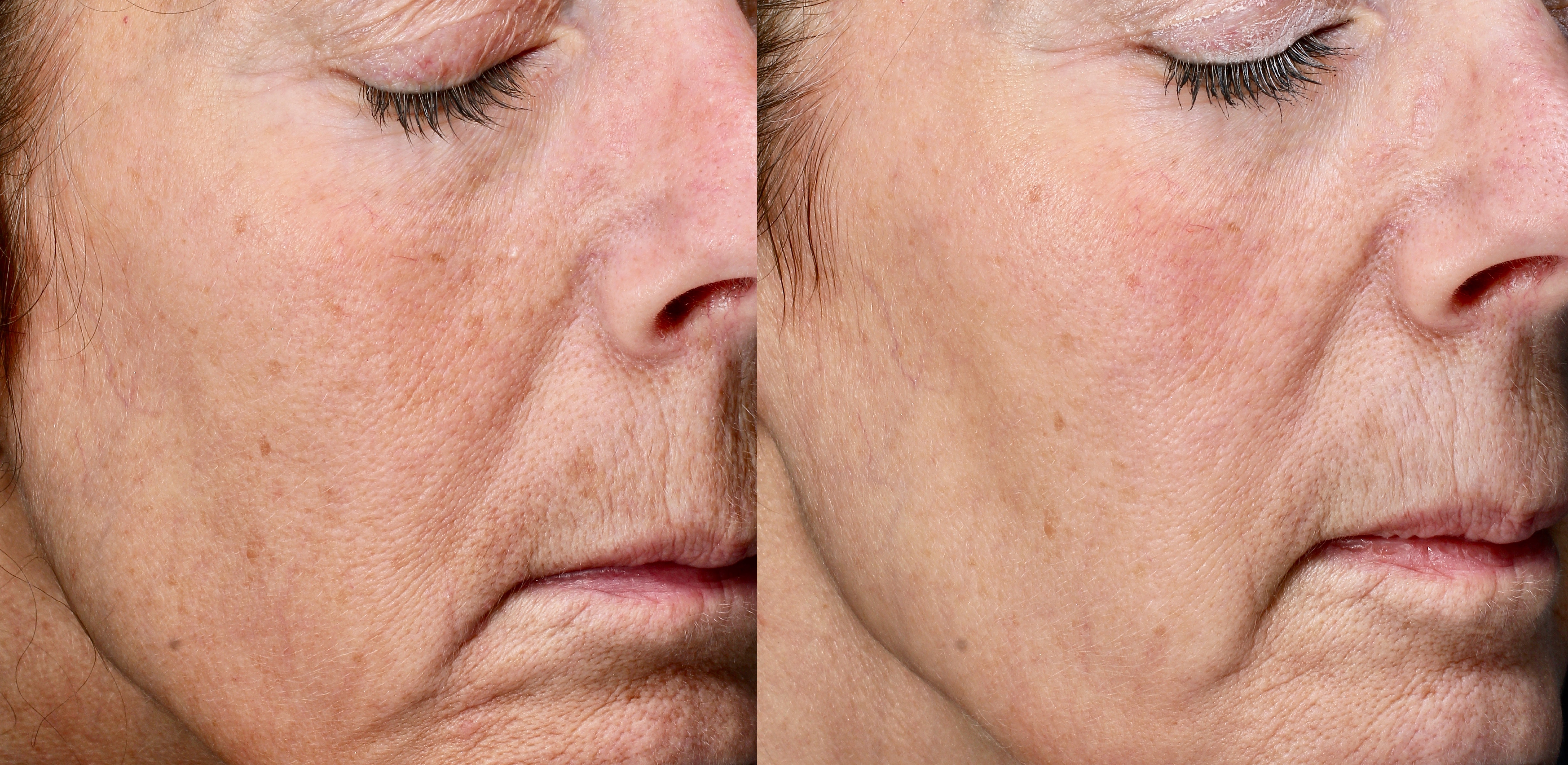 Patient B.W. Before